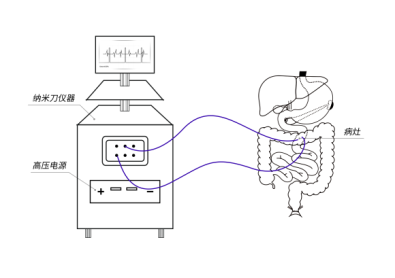 納米刀專(zhuān)用高壓電源_醫(yī)療